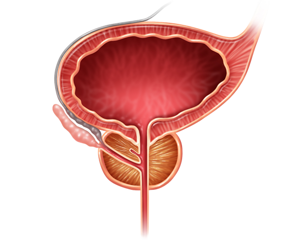 CX-5461/Talazoparib-Metastatic Castration Resistant Prostate Cancer